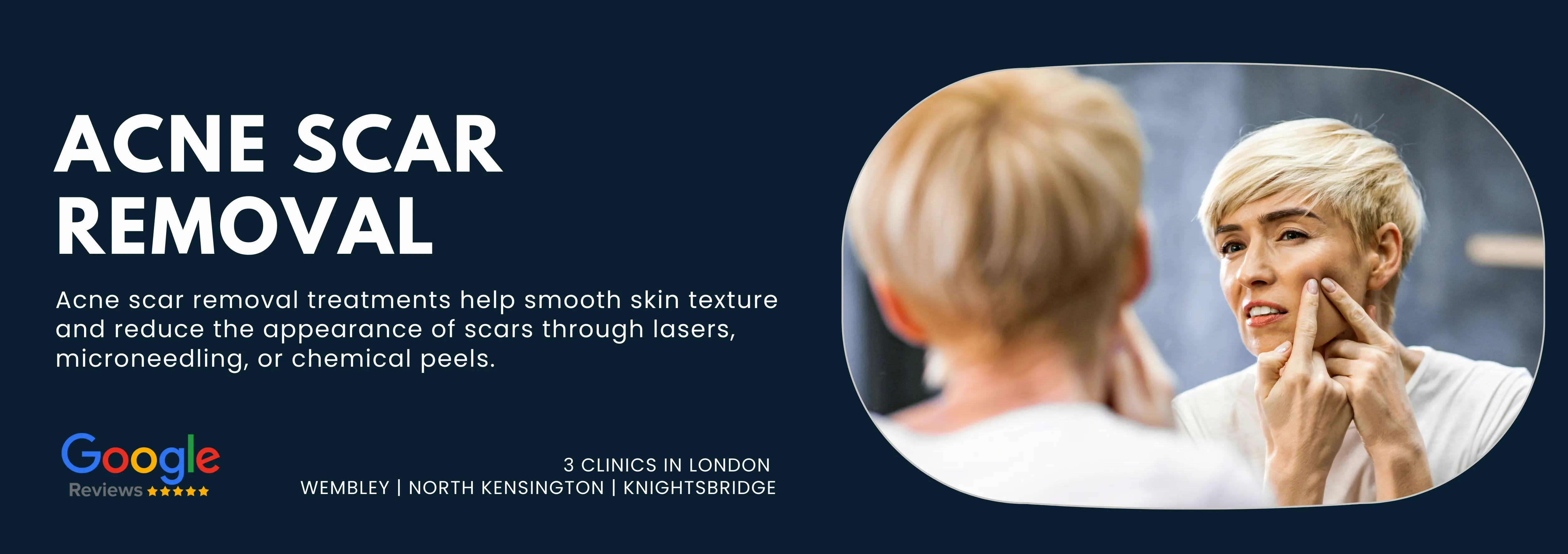 Acne Scar Removal