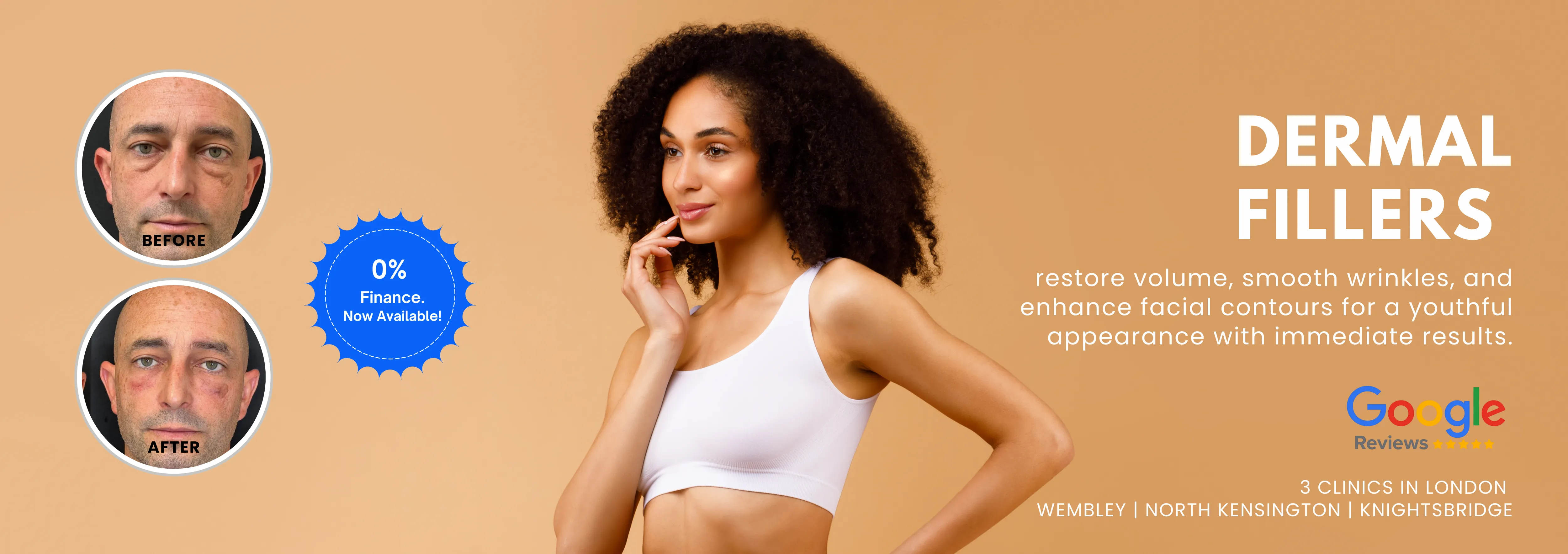 Dermal Fillers London