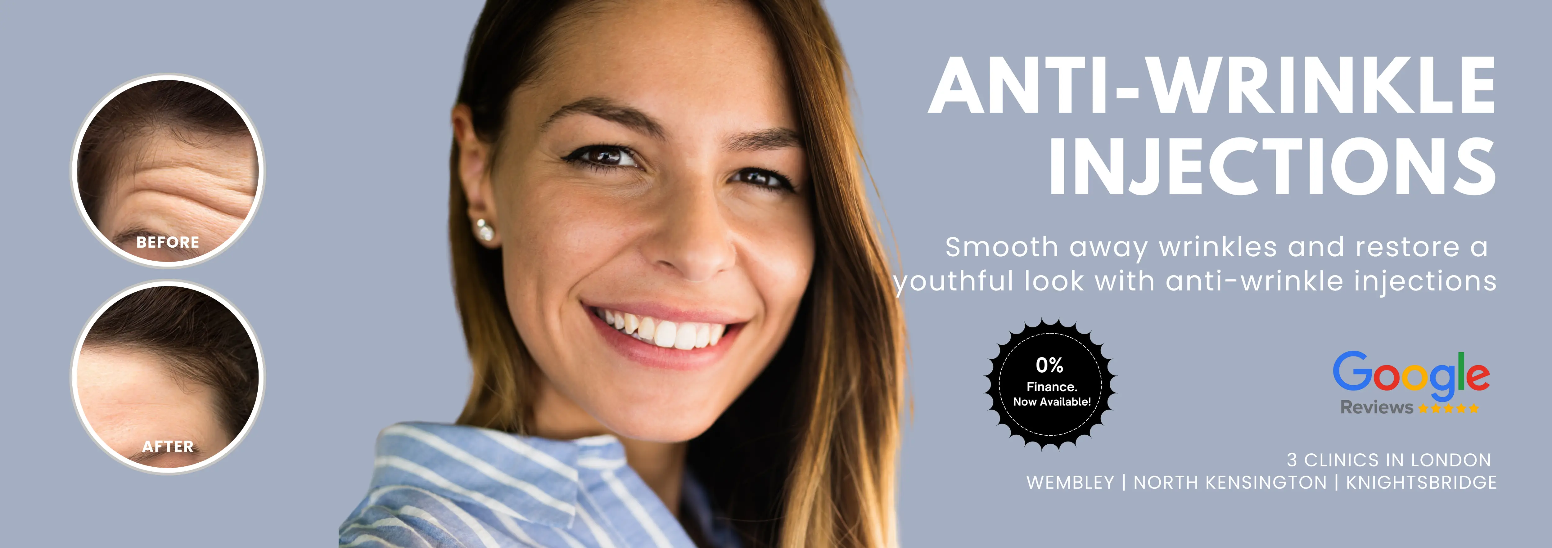 Anti Wrinkles Injection