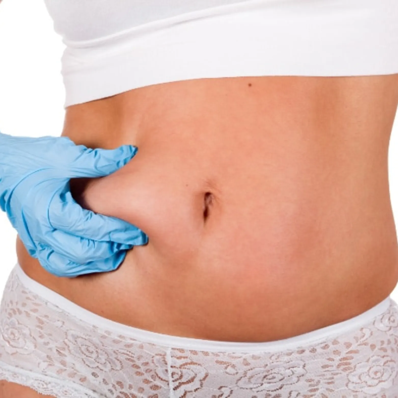 Liposuction