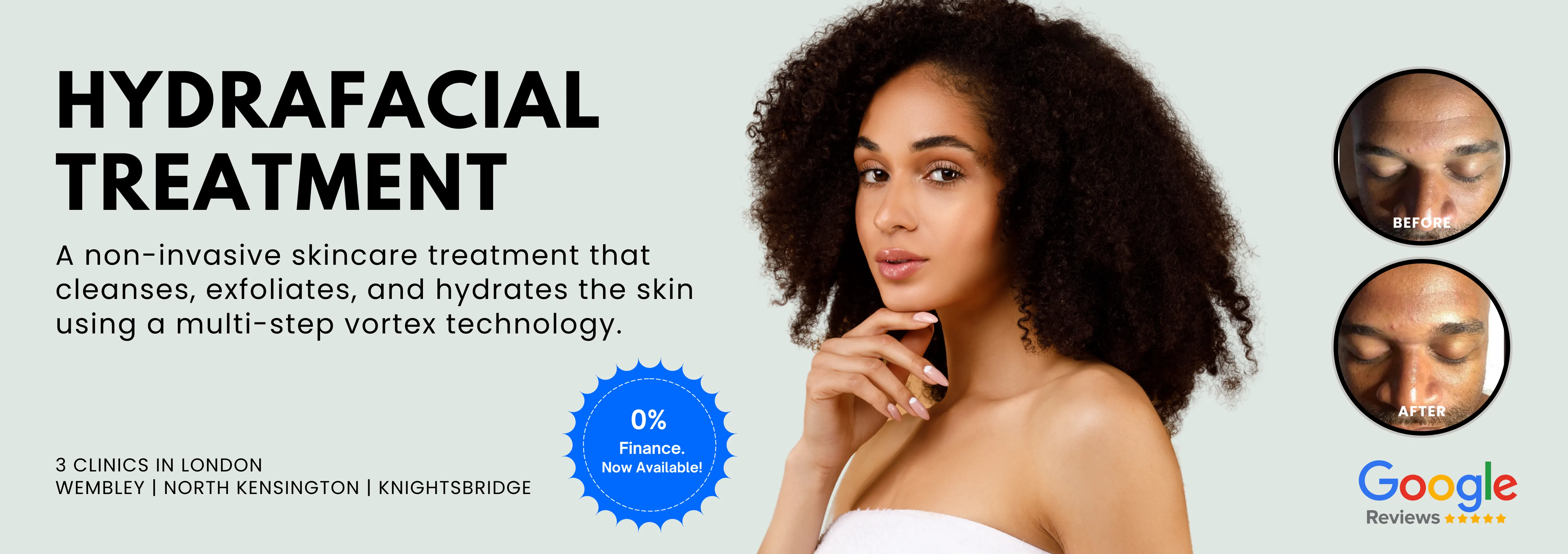 HydraFacial Treatment London