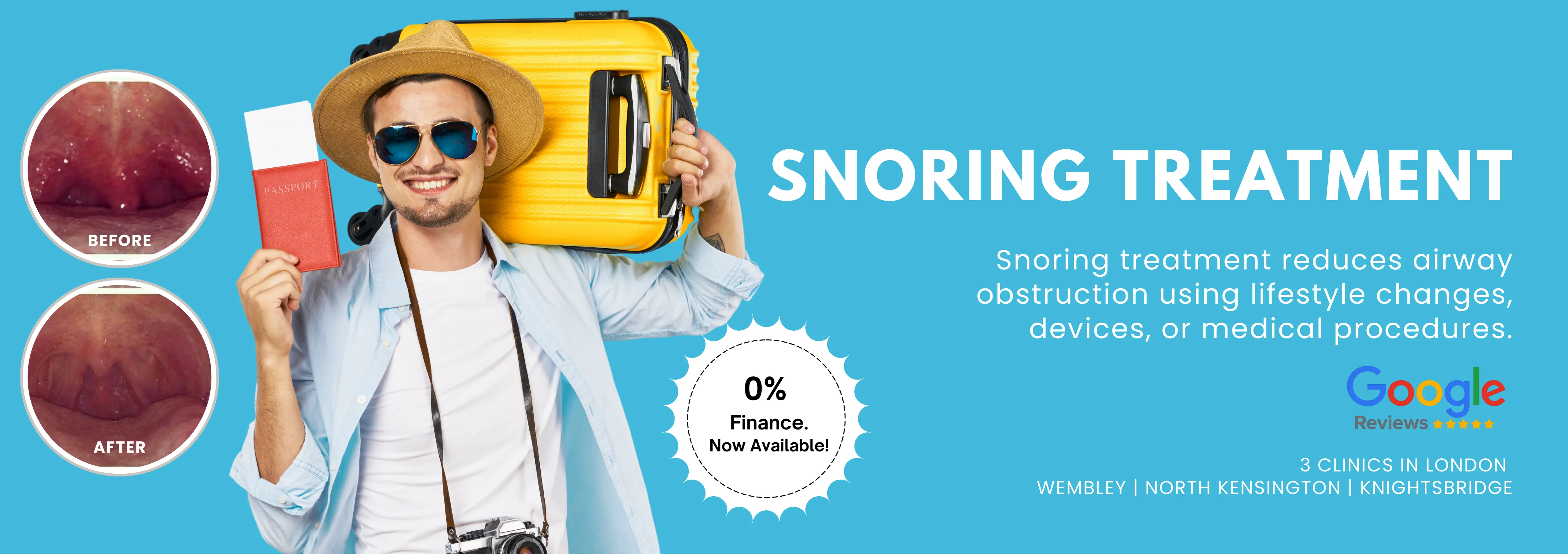 Laser Snoring Treatment