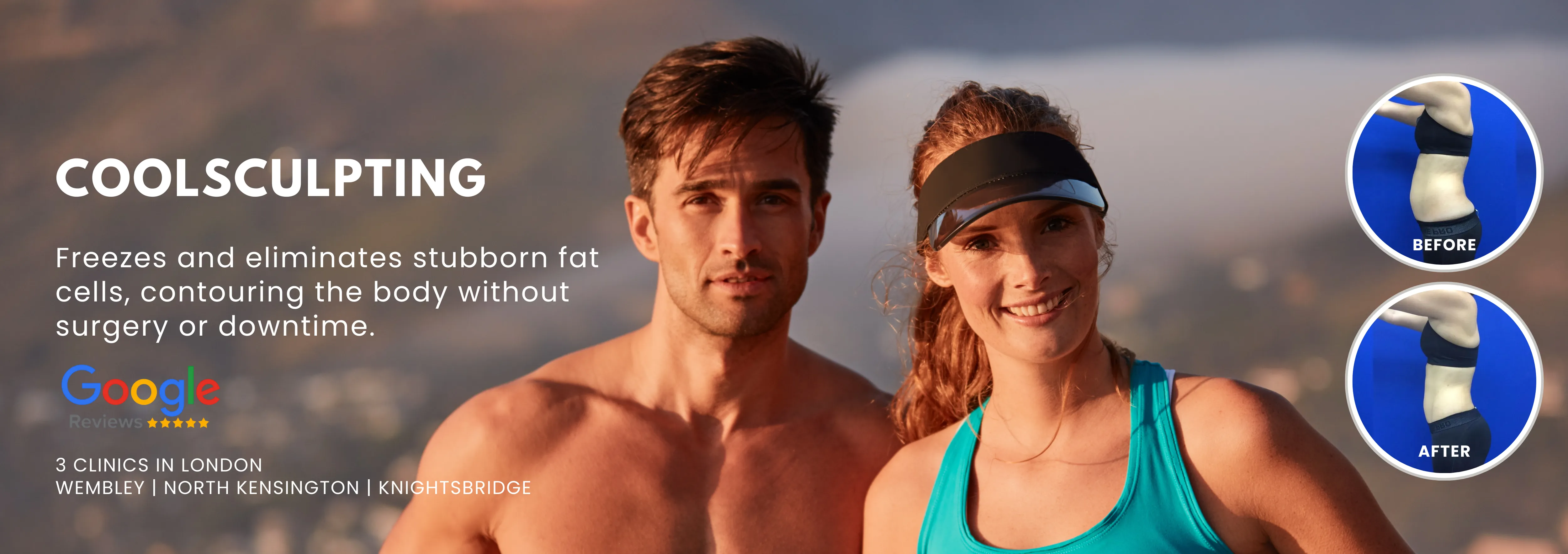 CoolSculpting