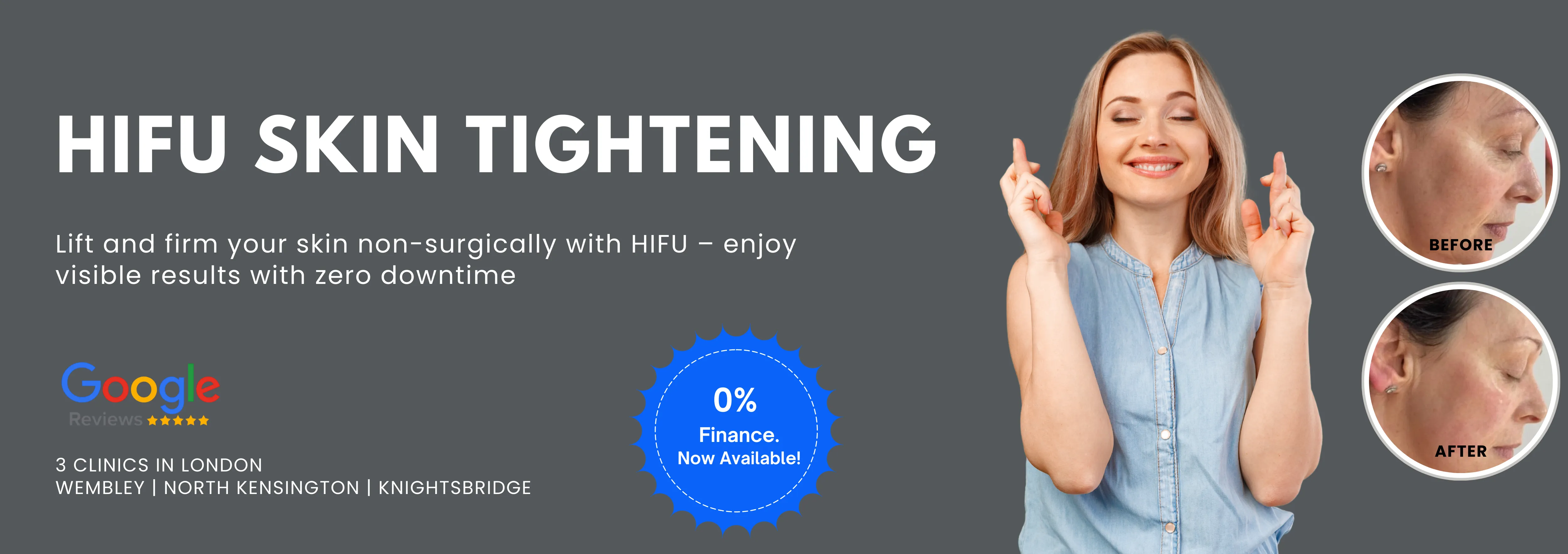 HIFU Skin Tightening