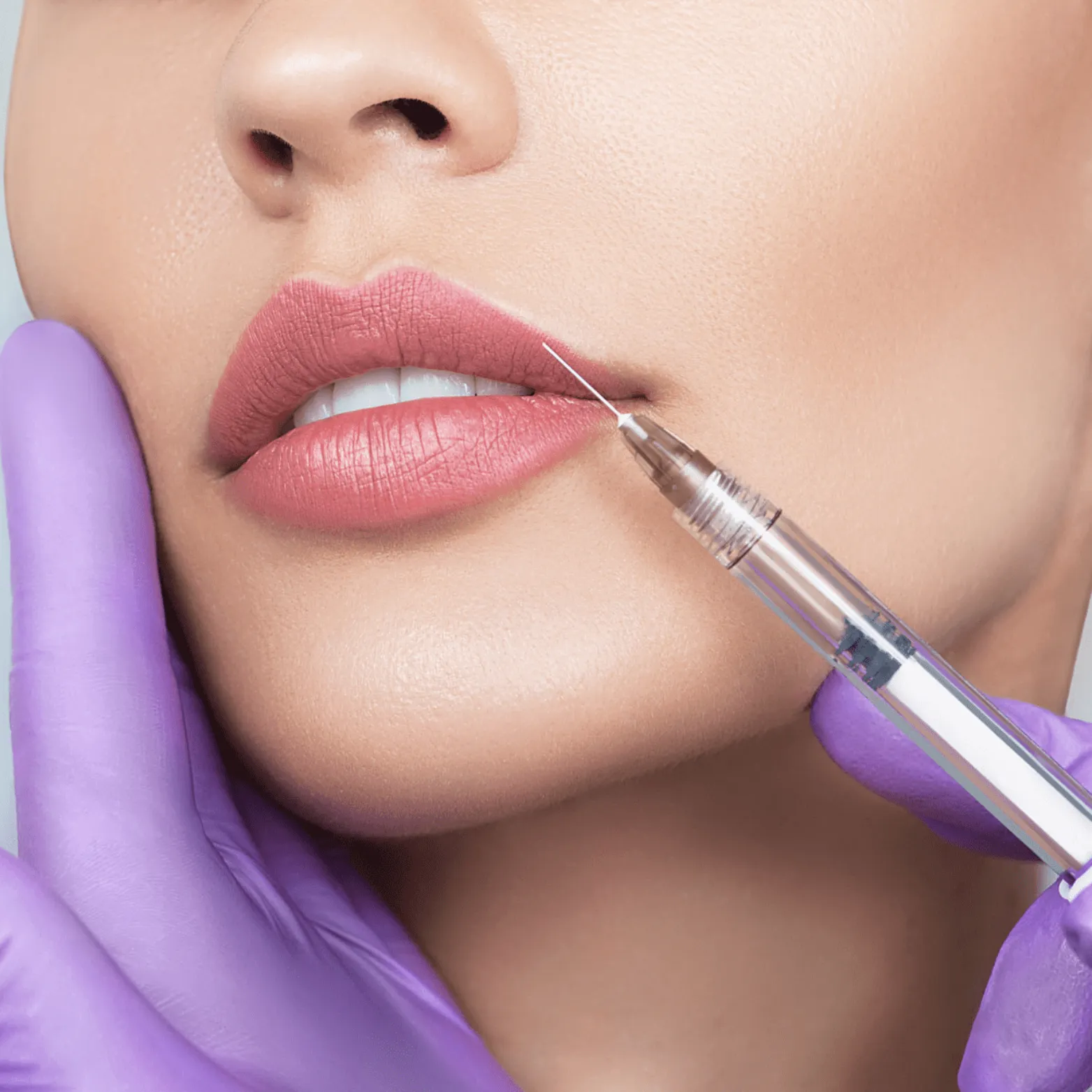 Dermal Fillers London